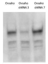 LRIG1 | Lig-1 (rabbit antibodies) in the group Antibodies for Human/Animal / Human Proteins / Other Human proteins at Agrisera AB (Antibodies for research) (AS18 4165)